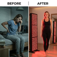 RN300 RN300 — Before & After